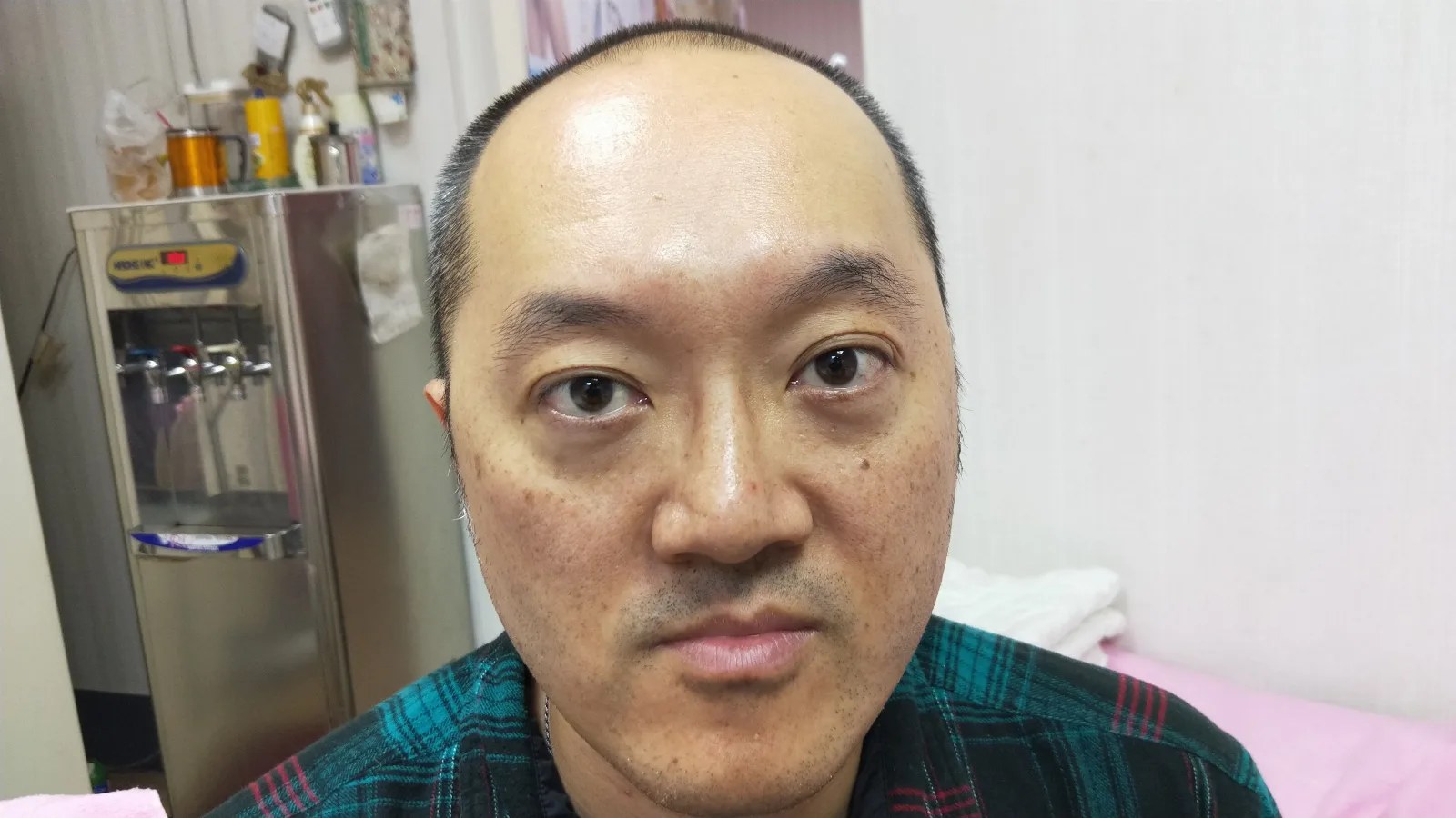 再次紀錄術前狀況