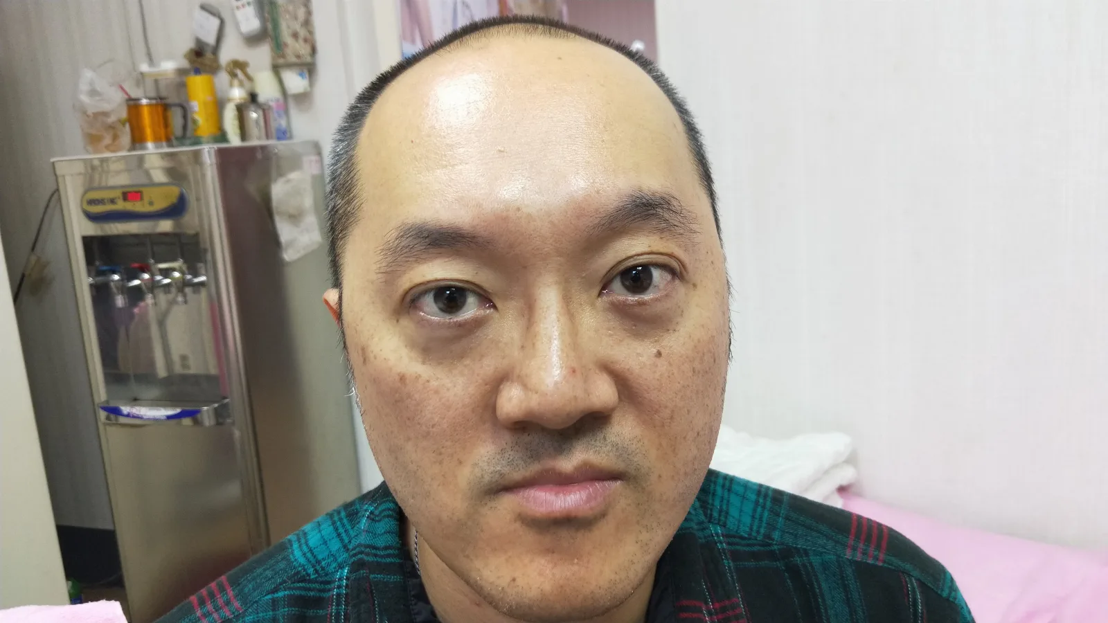 再次紀錄術前狀況