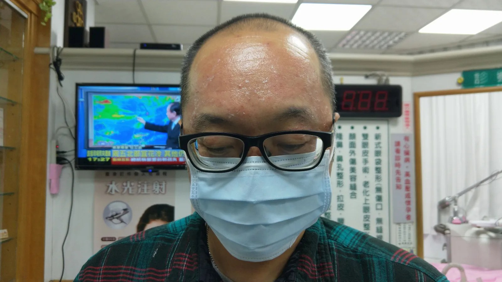 戴口罩離開，肌膚仍泛紅