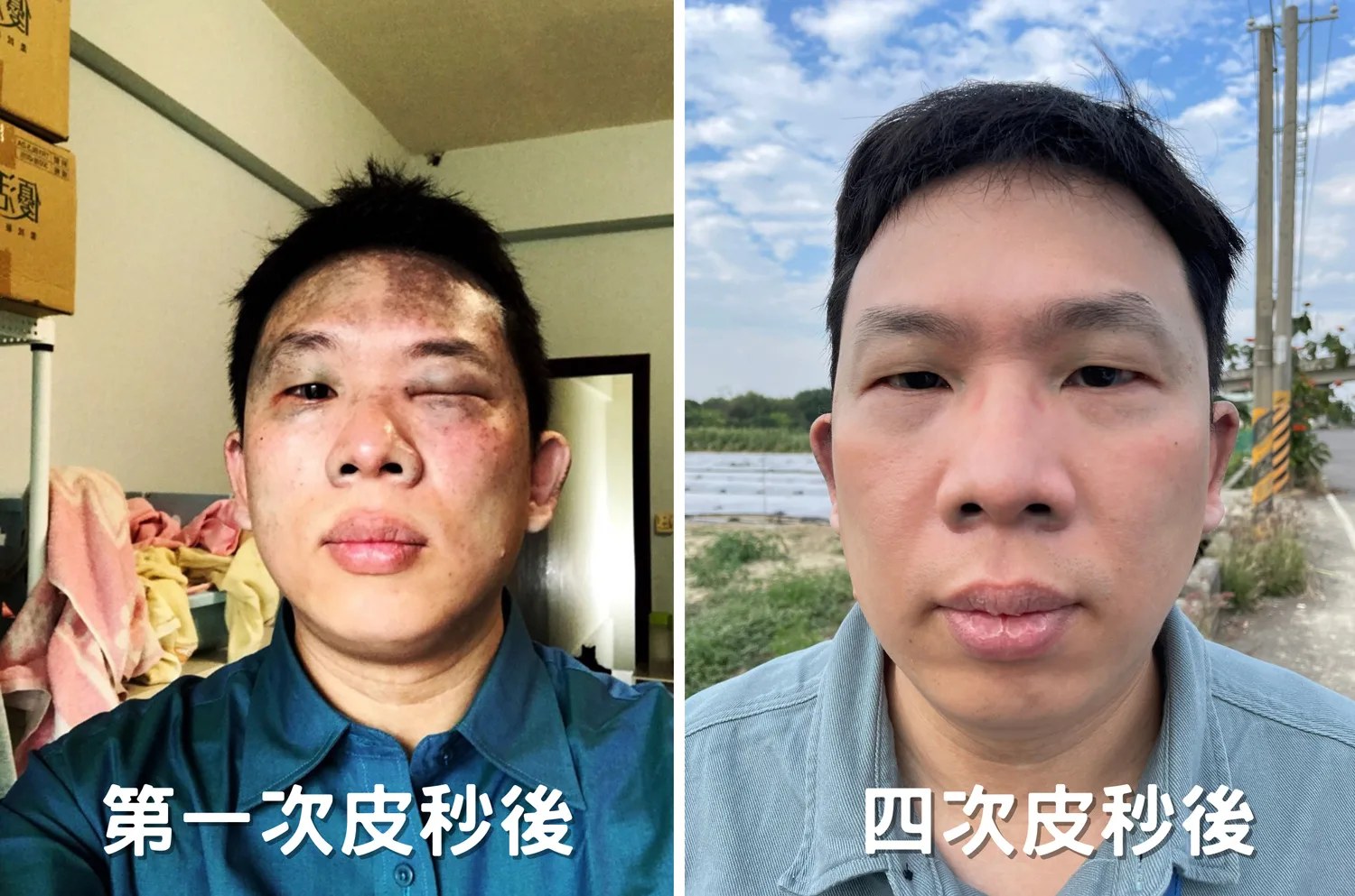 膚況明顯改善