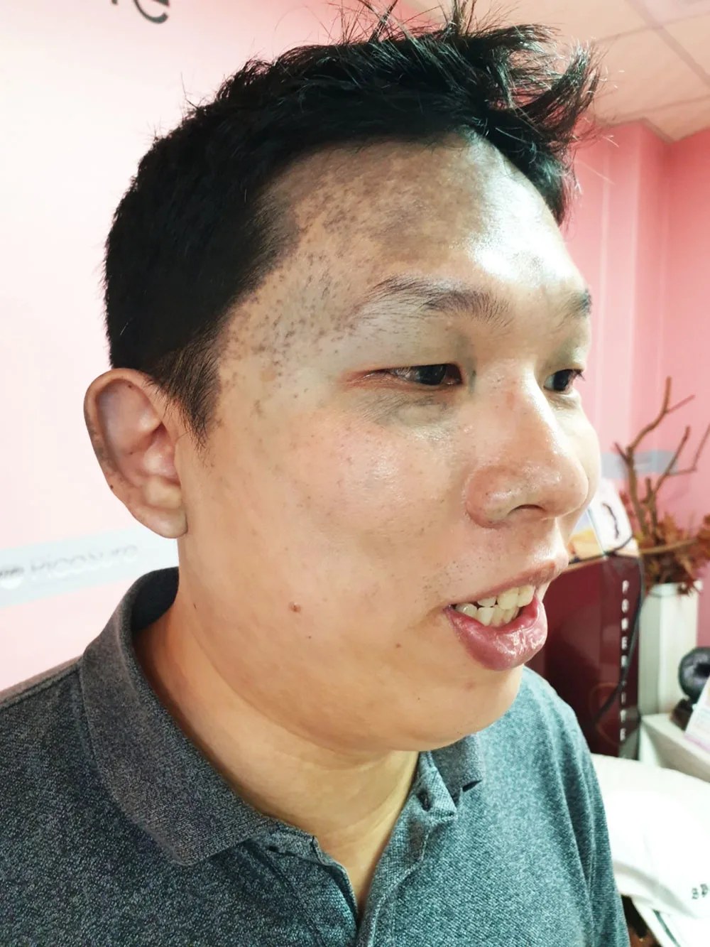 第一次施打前評估