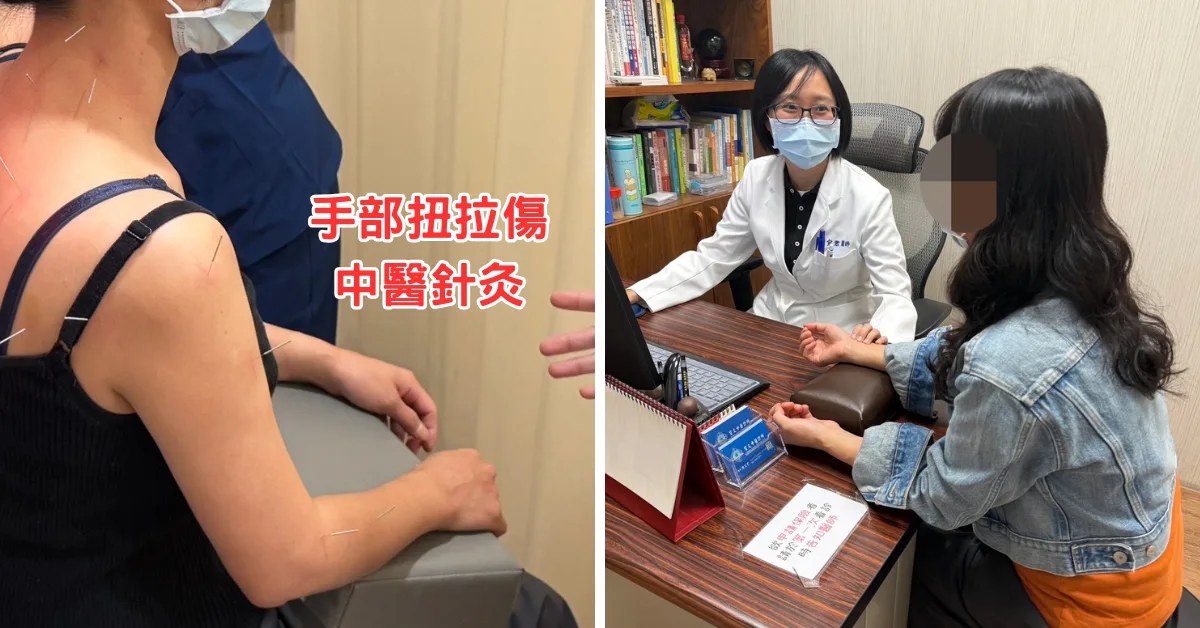 台南中醫推薦｜寳文中醫 手部扭拉傷針灸，肩膀卡卡有感改善