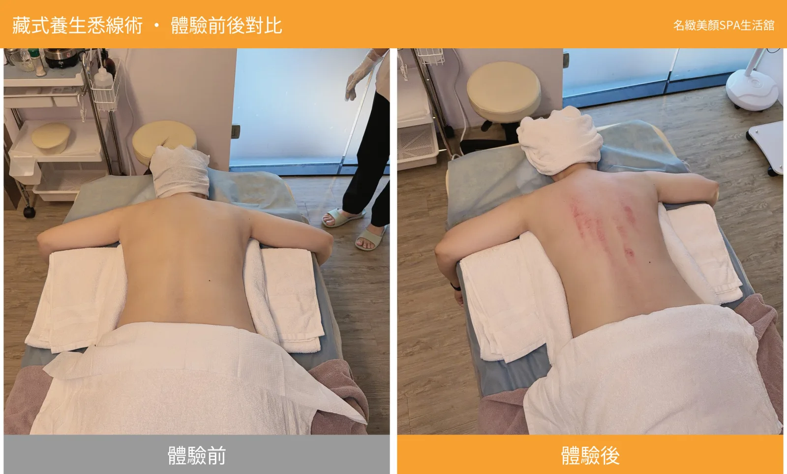藏式養生悉線術體驗前後背部對比